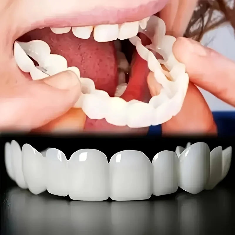 Snap in Veneers