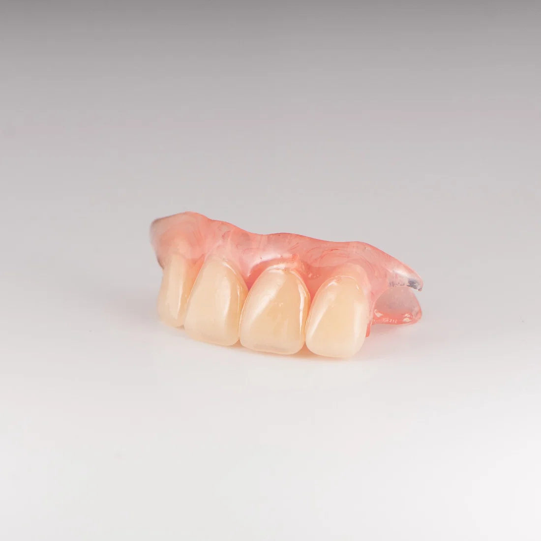 At -Home Custom Missing Tooth Replacement Kit