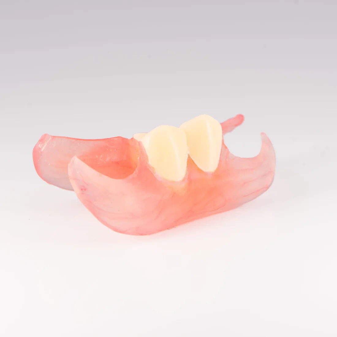 At -Home Custom Missing Tooth Replacement Kit
