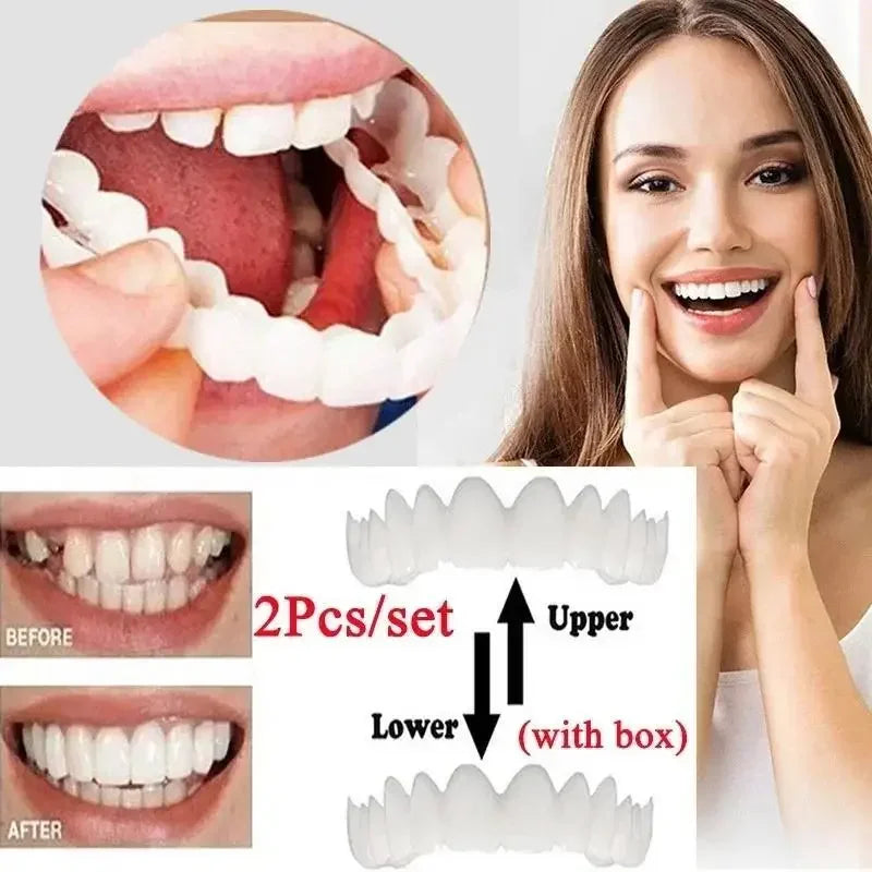 Snap in Veneers
